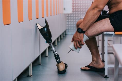 Austin-based startup revolutionizing how amputees control prosthetic limbs